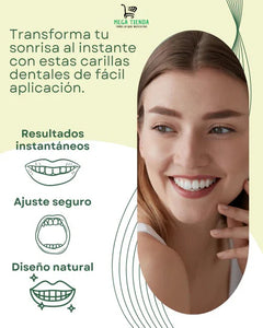 Carillas Dentales